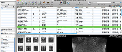 Osirix Viewer